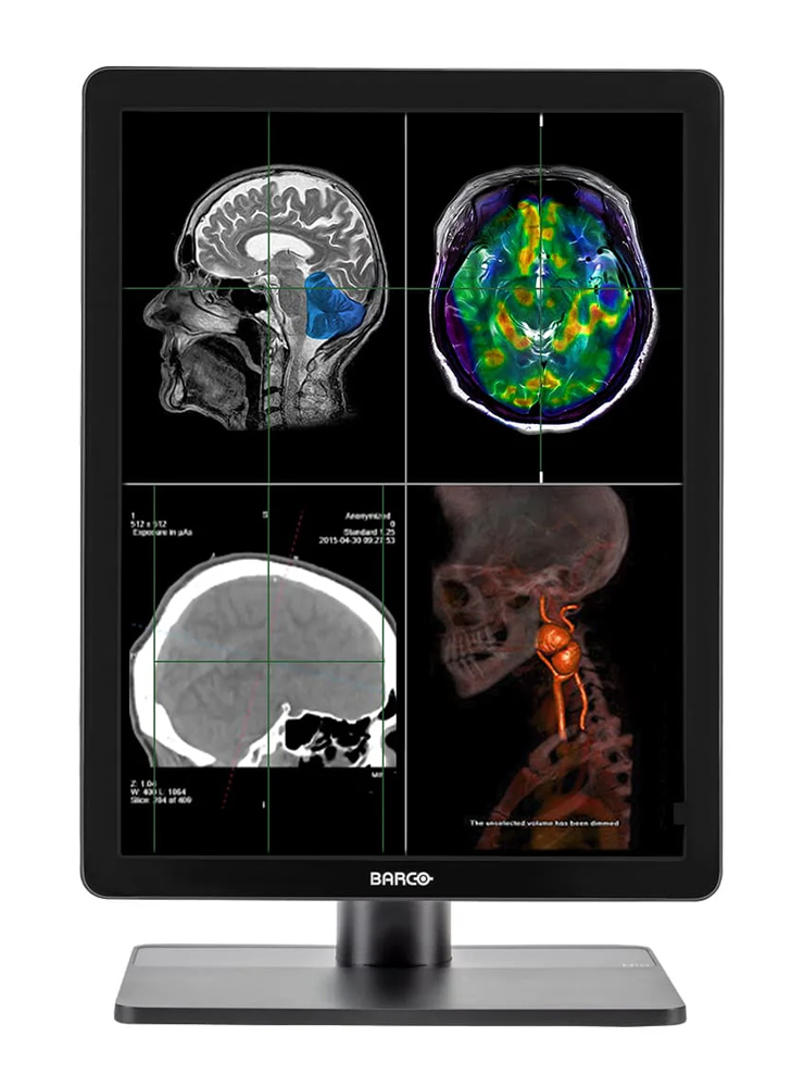 BARCO used οθόνη MDNC-2221 IPS-PRO, 21.3″, 1600×1200, Diagnostic Radiology Display, DVI/DisplayPort, Grade B